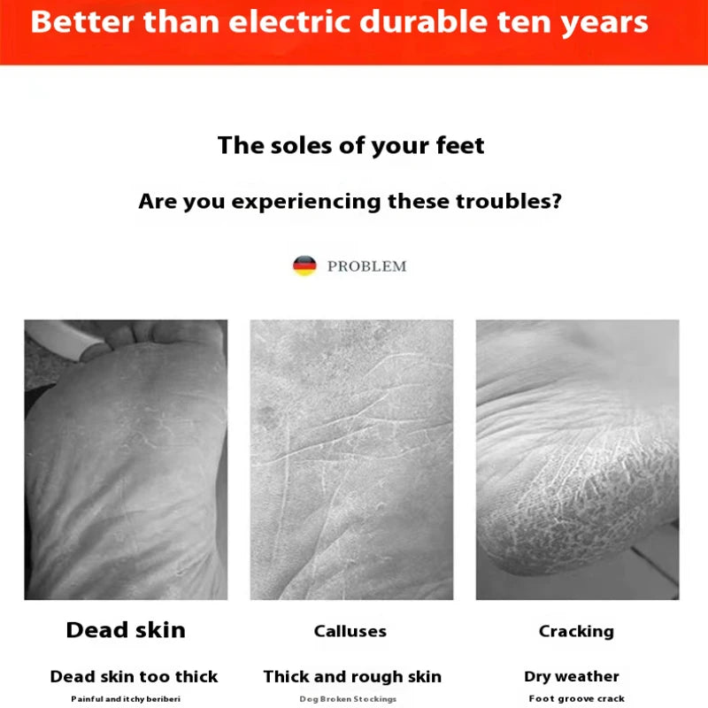 SoftAura Foot Grinder Dead Skin Remover Callus Scrubber Nano Glass